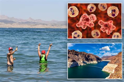 Brain-eating amoeba a danger at hot springs, Lake Mead officials warn